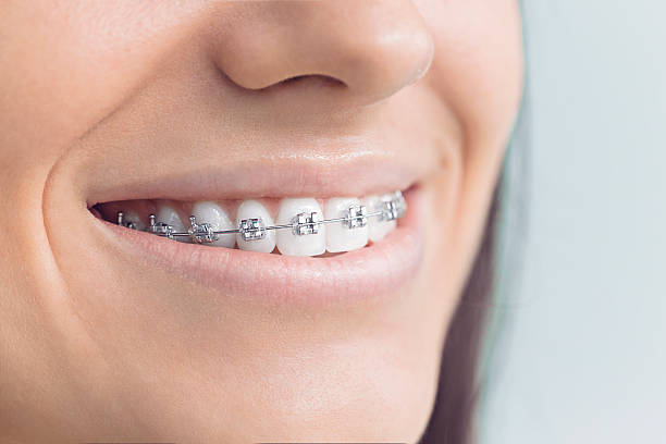 Trusted Montoursville, PA Holistic Dental Care Services Experts